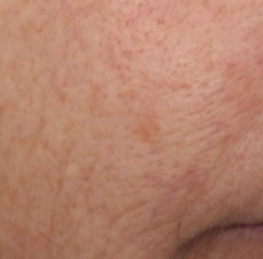 Before/After Image